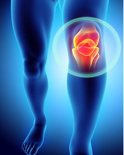 Total joint replacement