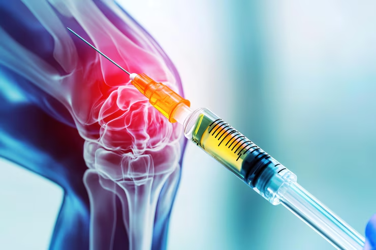 Total joint replacement