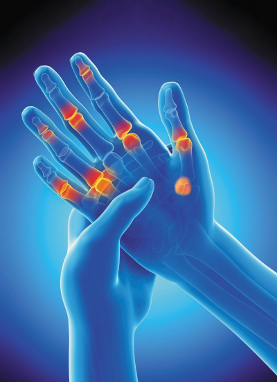 Robotic joint replacement