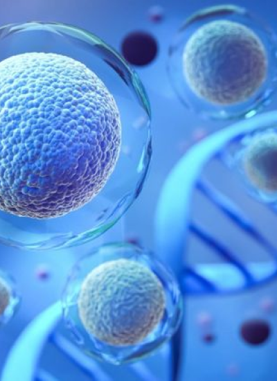 Total joint replacement