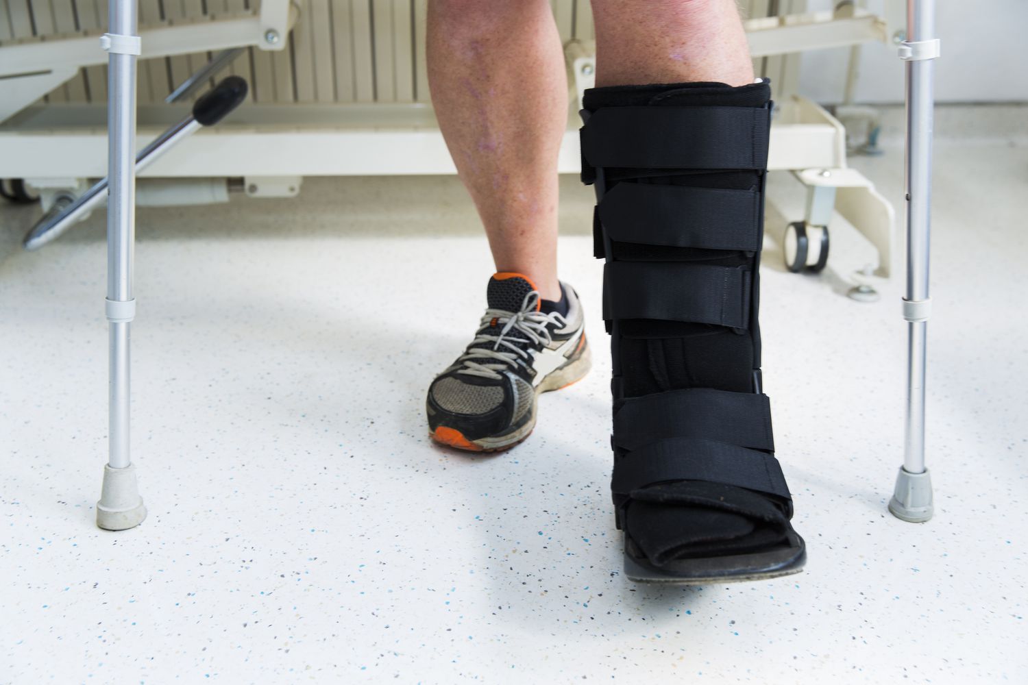 ankle replacement surgery