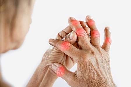 Arthritis doctor near me