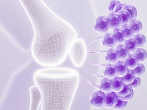 Total joint replacement